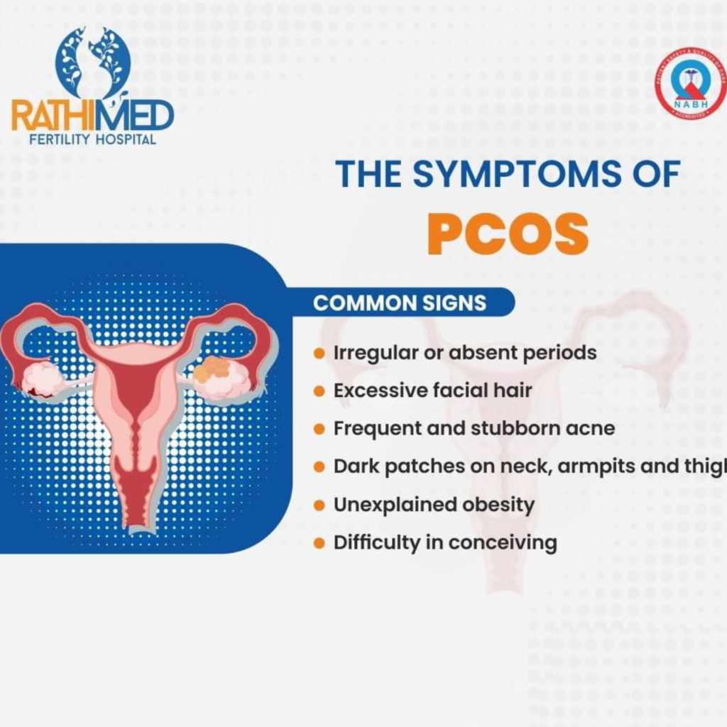 PCOS Treatment in Chennai