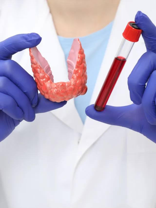 Endocrinologist in Chennai (1)